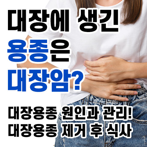 대장에 생긴 용종은 모두 대장암인가?