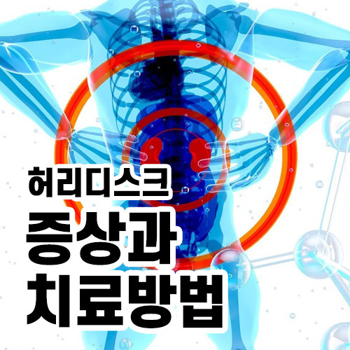 허리디스크 증상과 치료방법